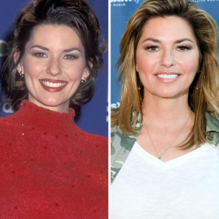 Shania twain smiling in photo before and after plastic surgery.